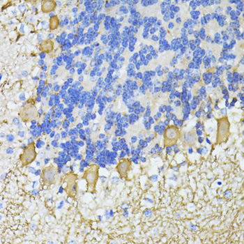 CA8 Rabbit Polyclonal Antibody - Image 2