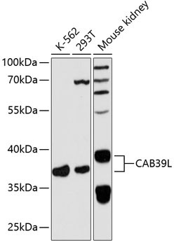 CAB39L Rabbit Polyclonal Antibody