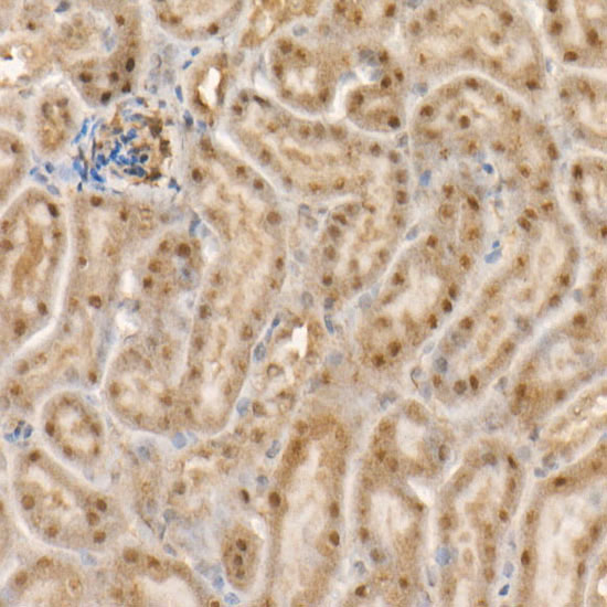 c-Abl Rabbit Monoclonal Antibody