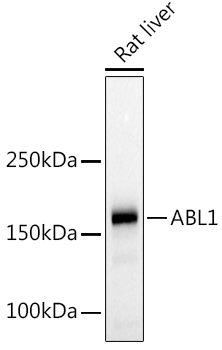 c-Abl Rabbit Polyclonal Antibody