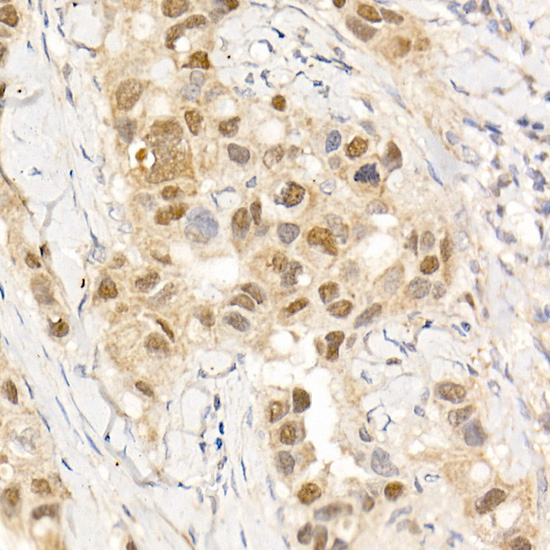 c-Abl Rabbit Polyclonal Antibody - Image 2