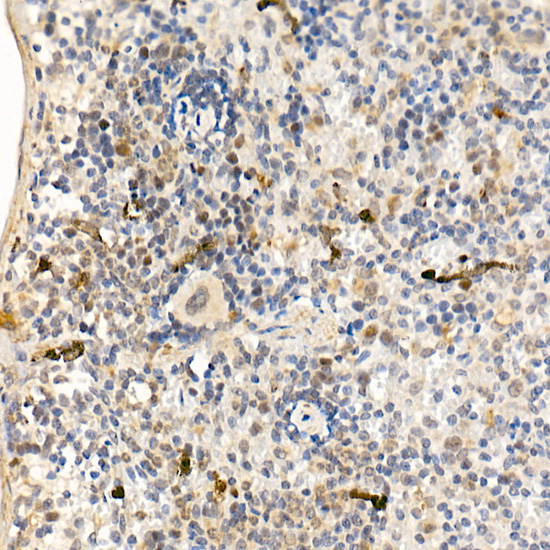 c-Abl Rabbit Polyclonal Antibody - Image 3