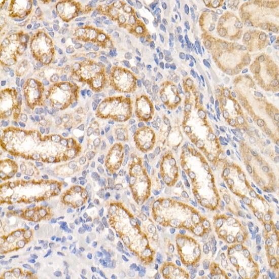 c-Abl Rabbit Polyclonal Antibody - Image 4