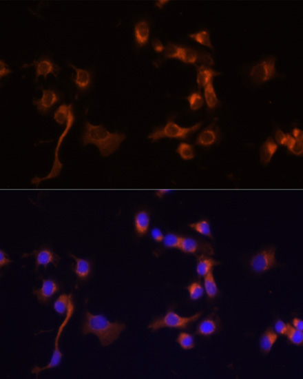 c-Abl Rabbit Polyclonal Antibody - Image 5