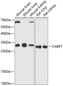 CABP7 Rabbit Polyclonal Antibody