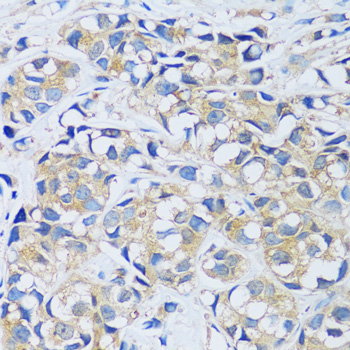 CABP7 Rabbit Polyclonal Antibody - Image 2