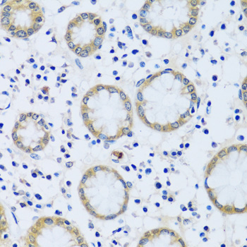 CABP7 Rabbit Polyclonal Antibody - Image 3