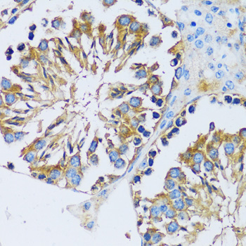 CABP7 Rabbit Polyclonal Antibody - Image 4