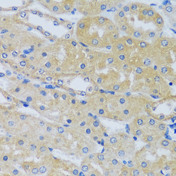 CABP7 Rabbit Polyclonal Antibody - Image 5