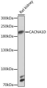 CACNA1D Rabbit Polyclonal Antibody