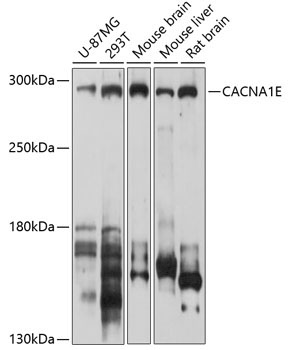 CACNA1E Rabbit Polyclonal Antibody