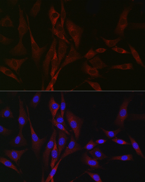 CACNA1H Rabbit Polyclonal Antibody