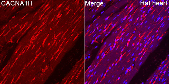CACNA1H Rabbit Polyclonal Antibody
