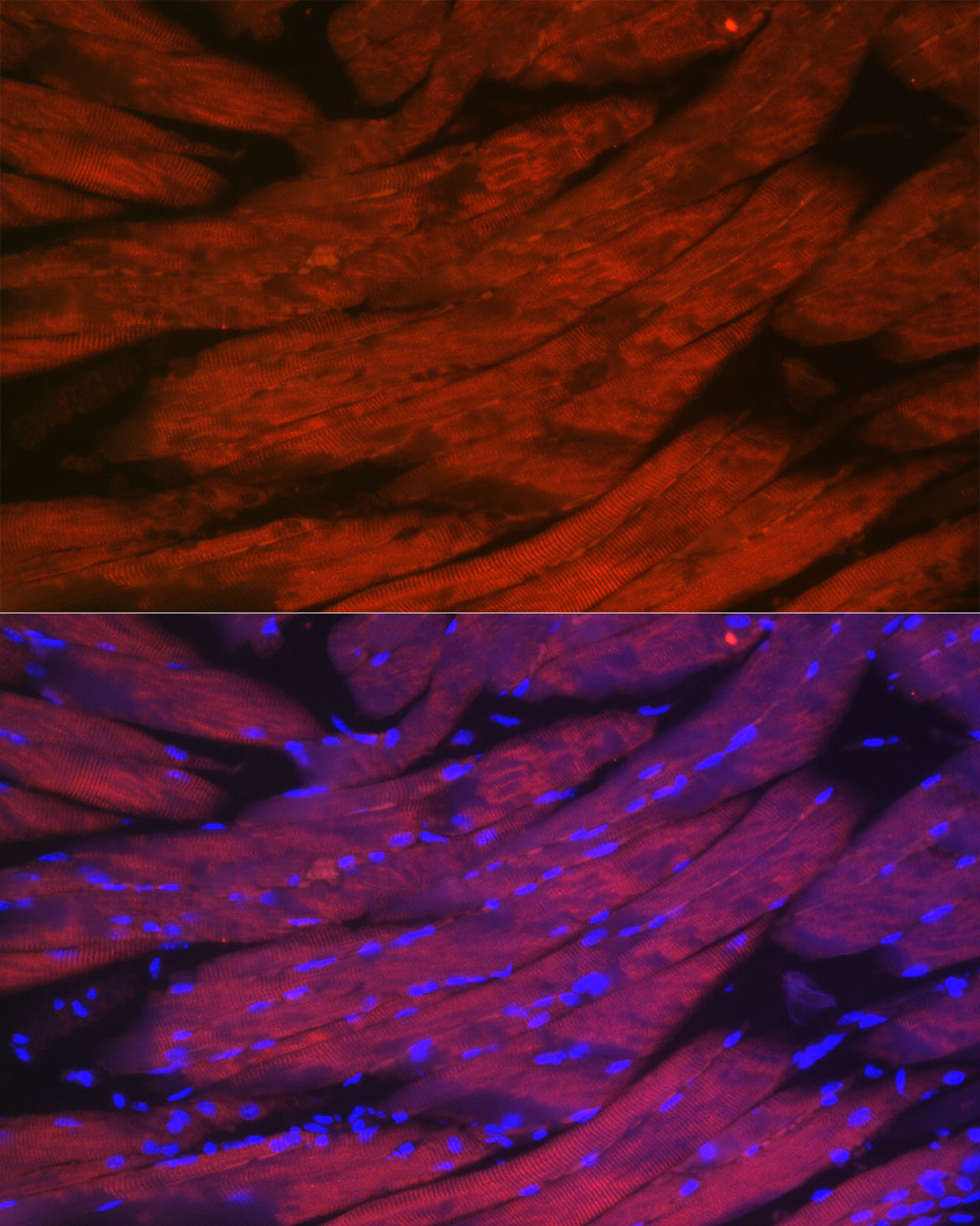 CACNA1S Rabbit Polyclonal Antibody