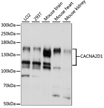 CACNA2D1 Rabbit Polyclonal Antibody