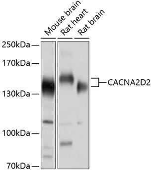 CACNA2D2 Rabbit Polyclonal Antibody