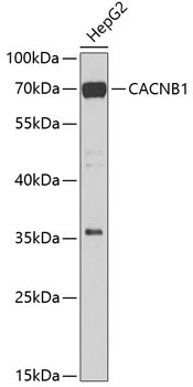 CACNB1 Rabbit Polyclonal Antibody