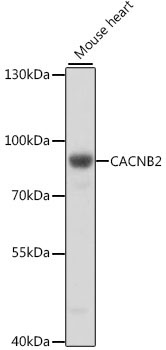 CACNB2 Rabbit Polyclonal Antibody