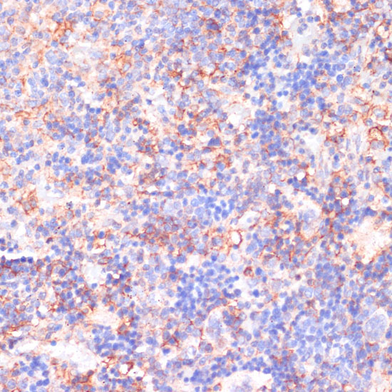 CACNB2 Rabbit Polyclonal Antibody - Image 2