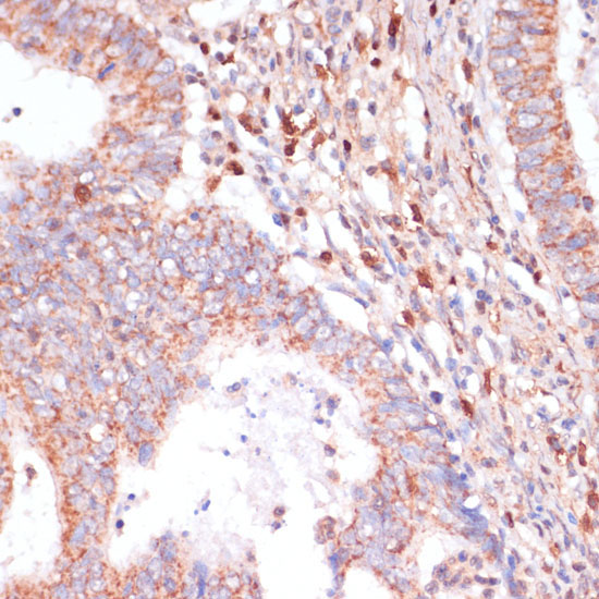 CACNB2 Rabbit Polyclonal Antibody - Image 3