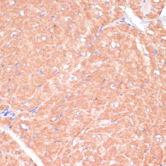CACNB2 Rabbit Polyclonal Antibody - Image 4