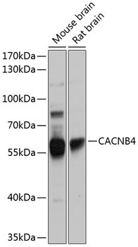 CACNB4 Rabbit Polyclonal Antibody