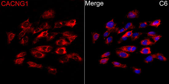 CACNG1 Rabbit Polyclonal Antibody