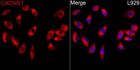 CACNG1 Rabbit Polyclonal Antibody - Image 2