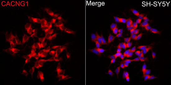 CACNG1 Rabbit Polyclonal Antibody - Image 3