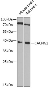 CACNG2 Rabbit Polyclonal Antibody