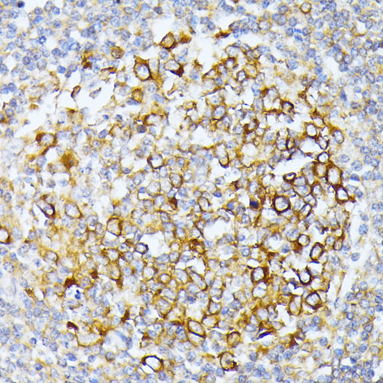CAD Rabbit Polyclonal Antibody - Image 2