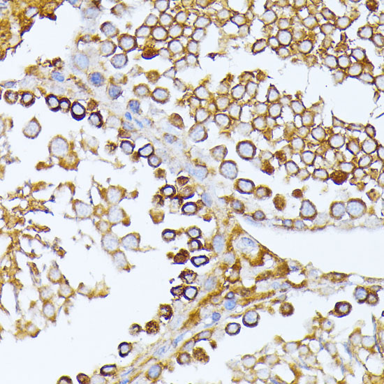 CAD Rabbit Polyclonal Antibody - Image 3