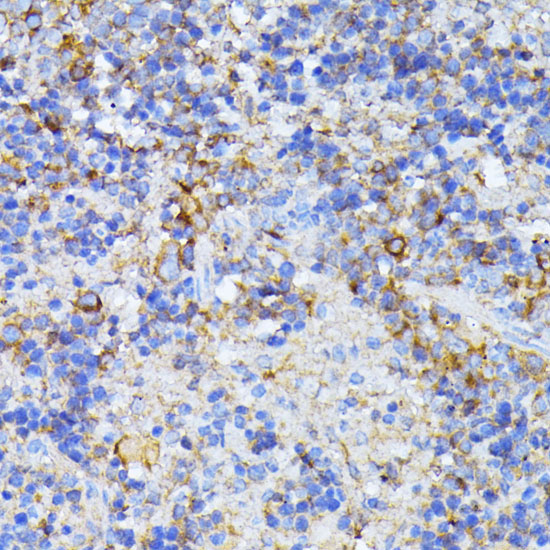CAD Rabbit Polyclonal Antibody - Image 4