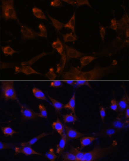CAD Rabbit Polyclonal Antibody - Image 5