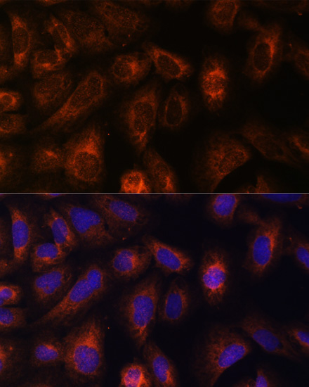 CAD Rabbit Polyclonal Antibody - Image 6
