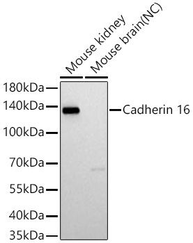 Cadherin 16 Rabbit Monoclonal Antibody
