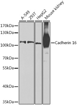 Cadherin 16 Rabbit Polyclonal Antibody