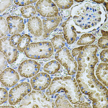 Cadherin 16 Rabbit Polyclonal Antibody - Image 2
