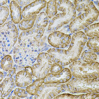 Cadherin 16 Rabbit Polyclonal Antibody - Image 3