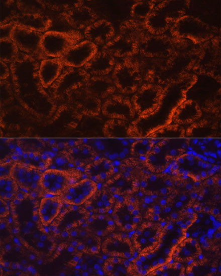 Cadherin 16 Rabbit Polyclonal Antibody - Image 4