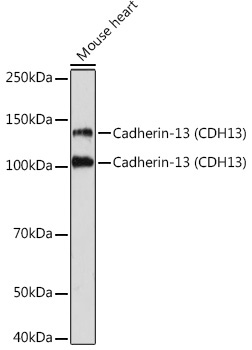 Cadherin-13 (CDH13) Rabbit Monoclonal Antibody
