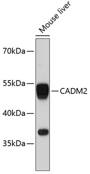 CADM2 Rabbit Polyclonal Antibody