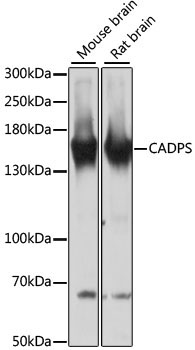 CADPS Rabbit Polyclonal Antibody