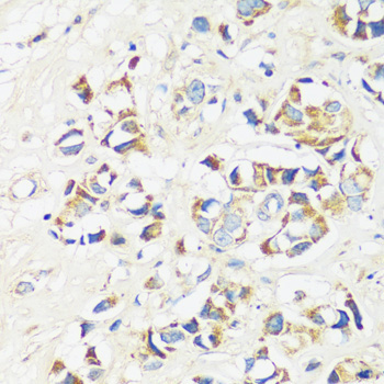 CADPS Rabbit Polyclonal Antibody