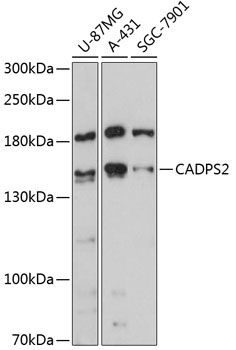 CADPS2 Rabbit Polyclonal Antibody