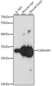 Calbindin Rabbit Polyclonal Antibody