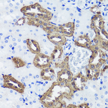 Calbindin Rabbit Polyclonal Antibody - Image 2