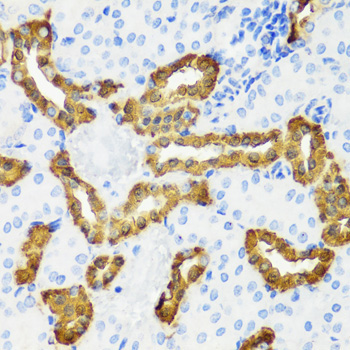 Calbindin Rabbit Polyclonal Antibody - Image 3