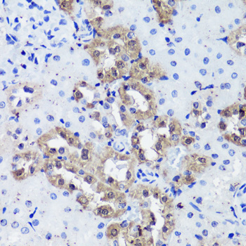 Calbindin Rabbit Polyclonal Antibody - Image 2