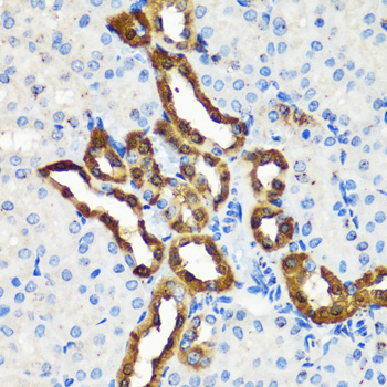 Calbindin Rabbit Polyclonal Antibody - Image 3